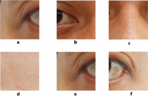 Development of coronary heart disease diagnosis system based on facial imagery